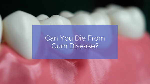 Can You Die From Gum Disease?