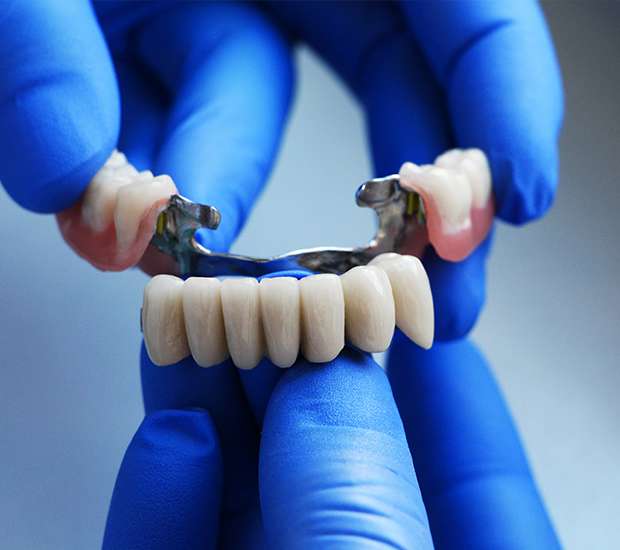 Babylon Dental Bridges