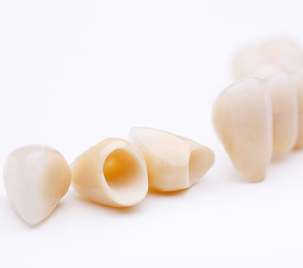 Babylon Dental Crowns
