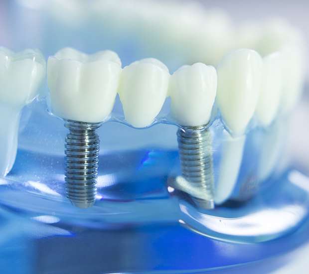 Babylon Dental Prosthetics