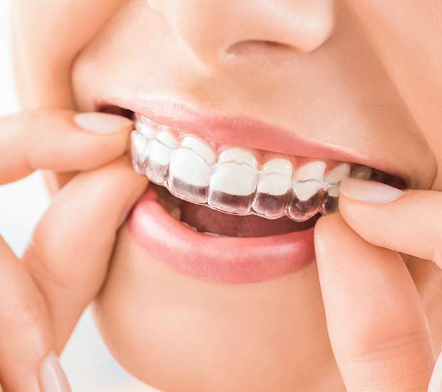 Babylon Does Invisalign® Really Work?