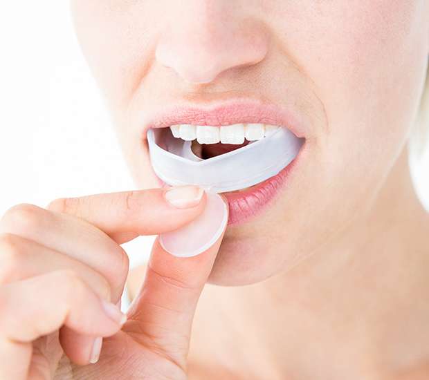 Babylon Mouth Guards
