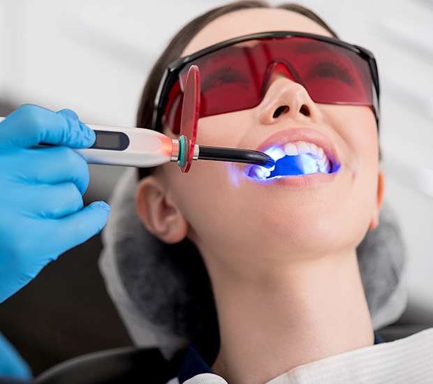 Babylon Professional Teeth Whitening