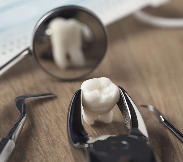 Babylon When Is a Tooth Extraction Necessary